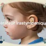 illustration oreille enfant avec aérateur transtympanique