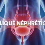 Illustration colique néphrétique avec rein et douleur