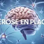Illustration cerveau et réseaux neuronaux pour sclérose en plaques